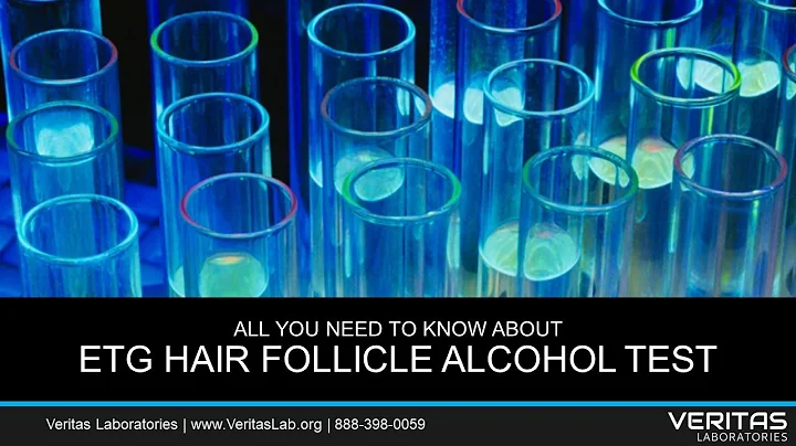EtG Hair Follicle Alcohol Test All You Need to Know FAQ
