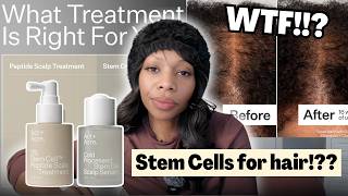 WTF Is in Act + Acre’s Stem Cell System? Act And Acre Serum And 3% Stem Cell Peptide Treatment!!