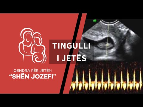 Video: 3 mënyra për të dëgjuar rrahjet e zemrës së fetusit