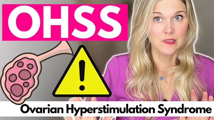 Ovarian Hyperstimulation Syndrome - OHSS Protocols...