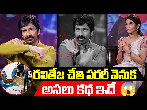 Ravi Teja’s Hand Surgery Story – What Really Happened? | TFPC - TFPC