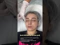 #косметологсочи #бьюти #биоревитализация #уходзакожей #сочи
