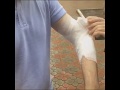 Оказание первой помощи при ранениях мягких тканей руки