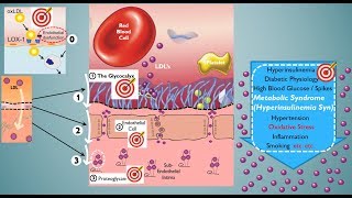 The Cholesterol Conundrum Part 2: Putting LDL Particle Count into Context