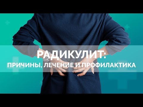 Радикулит: причины, лечение и профилактика