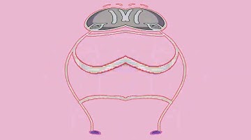 Preview 2 Distraction Dance Effects Extended In Real G Major 4 and Confusion