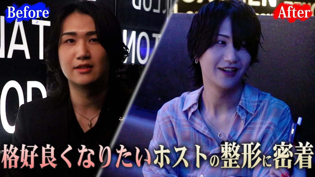 【整形密着】輪郭整形で姫も絶賛の横顔美男子！カッコよくいたいホストの整形に密着！【TCB東京中央美容外科】