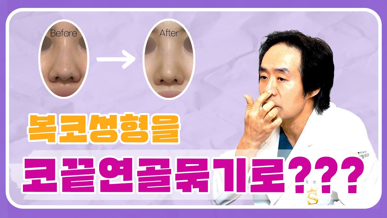 [코끝연골묶기] 복코성형을 코끝연골묶기로 할 수 있다고???