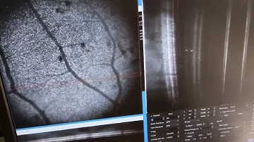 3D holographic OCT image rendering at 10 GB/s