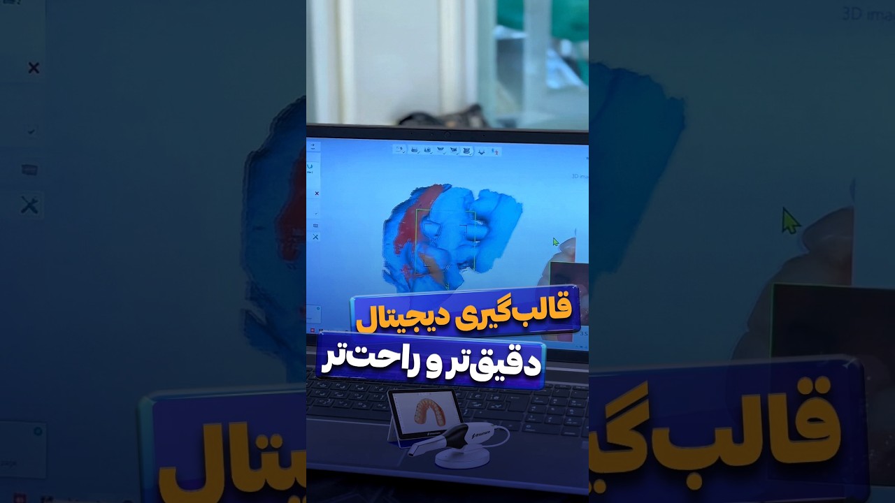 کاور ویدیوی یوتیوب