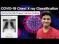 How I Built a COVID-19 X-Ray Classifier 🔥 | Deep Learning Computer Vision Project
