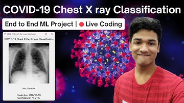 How I Built a 🦠 COVID-19 X-Ray Image Classifier 🔥 |  Computer Vision + Machine Learning Project