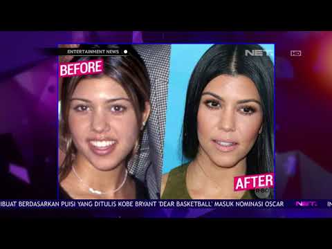 Video: Operasi Plastik Apa Yang Dilakukan Kim Kardashian Selama 13 Tahun Keikutsertaannya Dalam Sebuah Reality Show