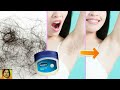 Vaselin 5 मिनट में अनचाहे बाल ऐसे खत्म हो जायेंगे की दोबारा नहीं आएंगे/Remove unwanted hair