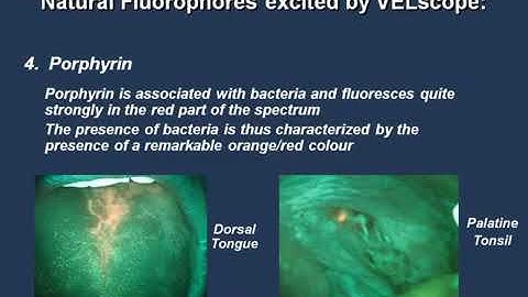 An Introduction to Tissue Fluorescence: How Does It Work?