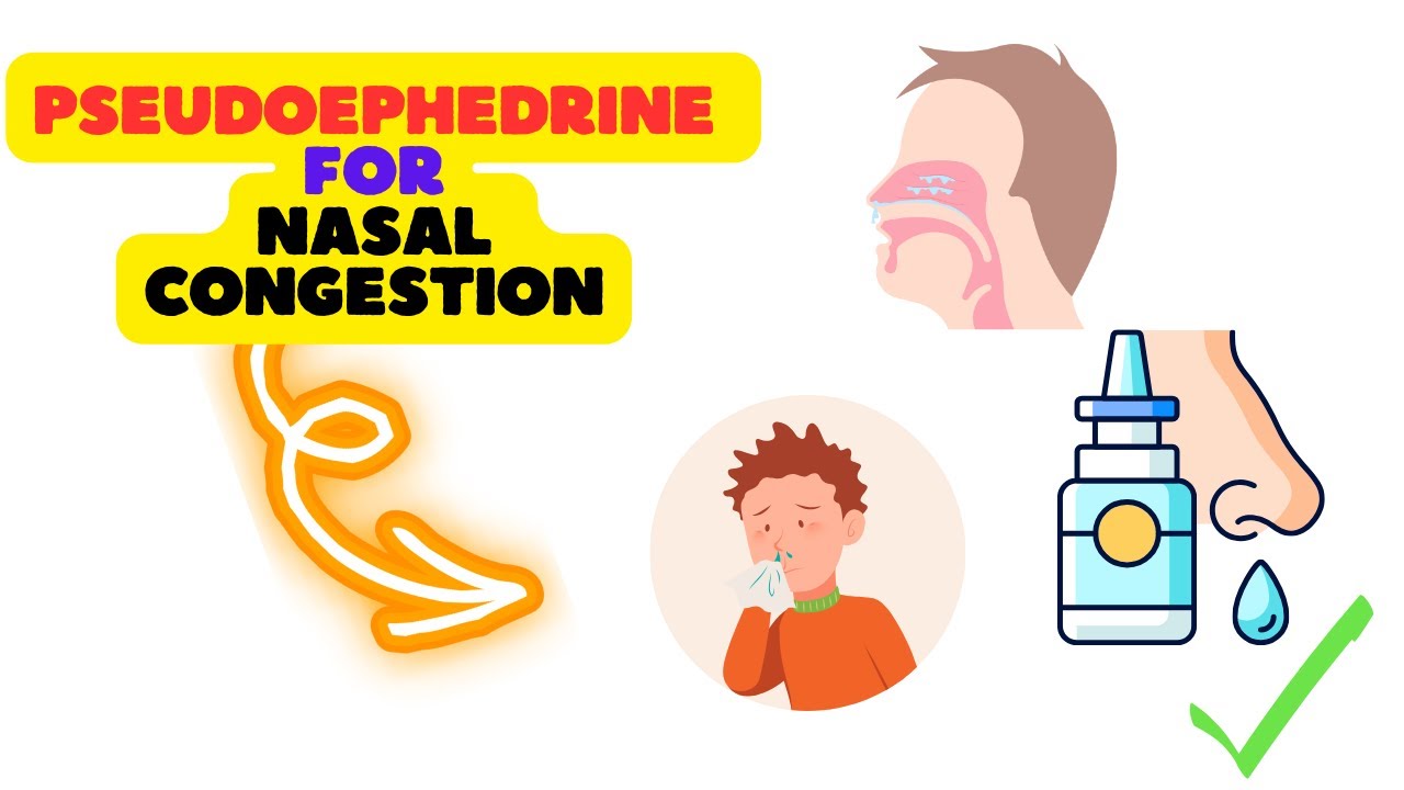Pseudoephedrine Side Effects Revealed: What You Need to Know Before Taking Decongestants