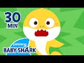 Baby Shark&#39;s Hiccup Doesn&#39;t Stop! | +Compilation | Baby Shark WHY Songs | Baby Shark Official