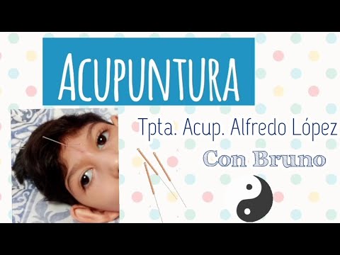 Acupuntura - Niños con Parálisis Cerebral