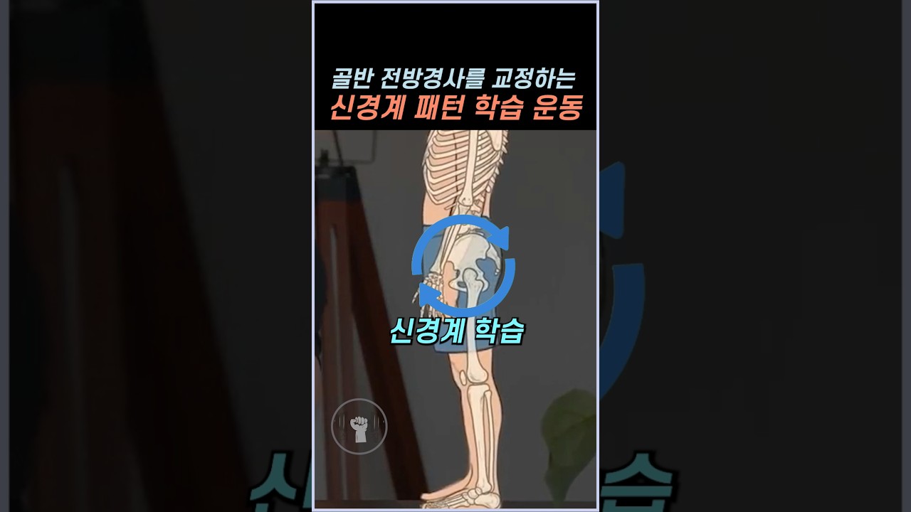 골반 전방경사를 교정하는 신경계 패턴 학습 운동