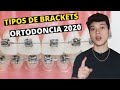 🔴  ESTOS SON LOS TIPOS DE BRACKETS QUE DEBES CONOCER ANTES DE UN TRATAMIENTO DE ORTODONCIA 2020.