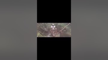 RareView Vision is an interactive tool for the user