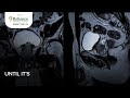 Prostate Cancer Awareness Month | September