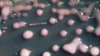 Doctors Struggle to Contain New Bacteria