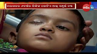 Ear Drop application on Rinki's Eye, Lost Eyes || Who is Responsible? || MBCtv screenshot 5