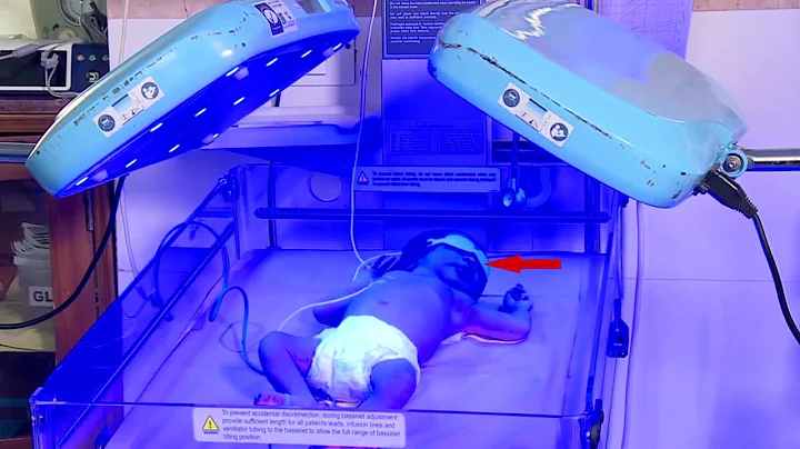 Care of an infant  while under phototherapy 2021 - DayDayNews