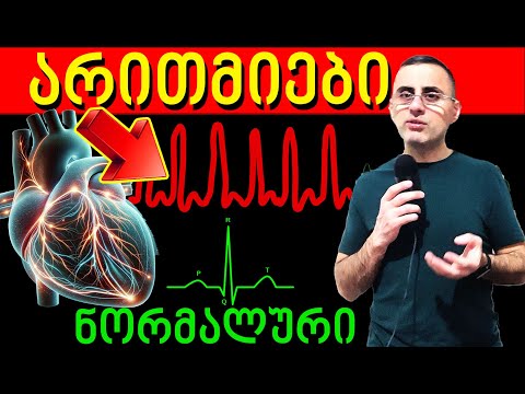რა იწვევს გულის არითიებს,  გულის აჩქარება, გულის ფრიალი, პულსის ამოვარდნა