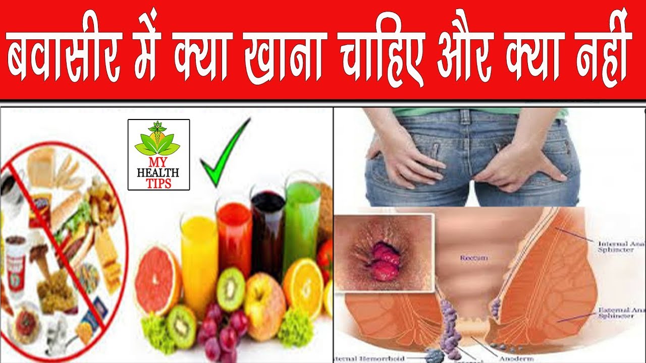 बवासीर में क्या खाएं और क्या न खाएं। Piles (Hemorrhoids) Treatment ...