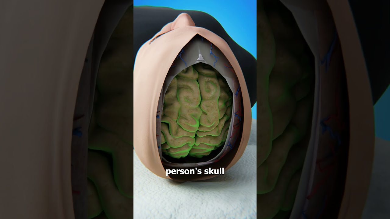 Is It Possible To Swap Brains 