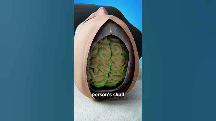 Is It Possible To Swap Brains? 🤔