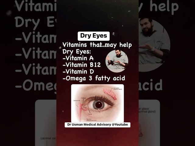 Dry Eyes-Vitamins that may help Dry Eyes#dryness #eyes #dryeye