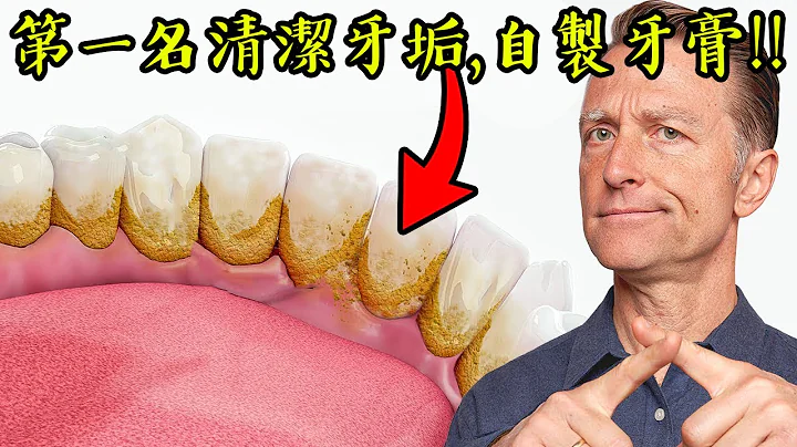 【牙齿】第一名去除牙垢、牙结石、牙菌斑的天然牙膏,柏格医生 Dr Berg - 天天要闻