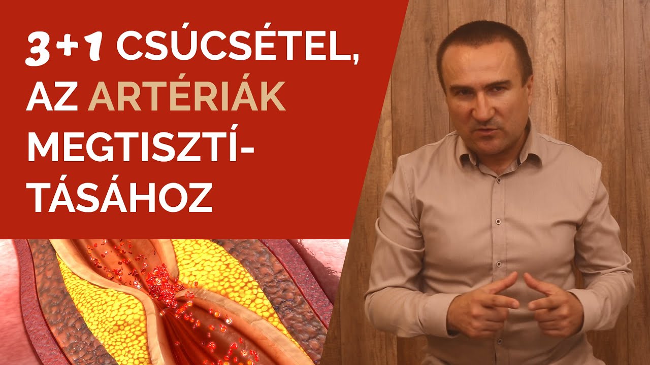 3+1 csúcs-étel az Artériák megtisztításához