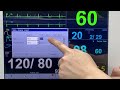 PROMISE PRO-M12D Patient Monitor Alarm Limit Setting