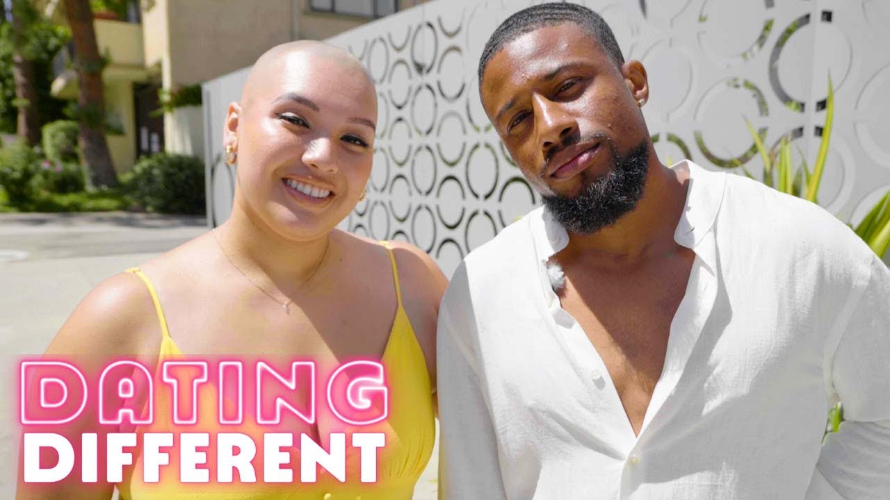I Used To Hide My Bald Head - Now I'm Ready To Date | DATING DIFFERENT
