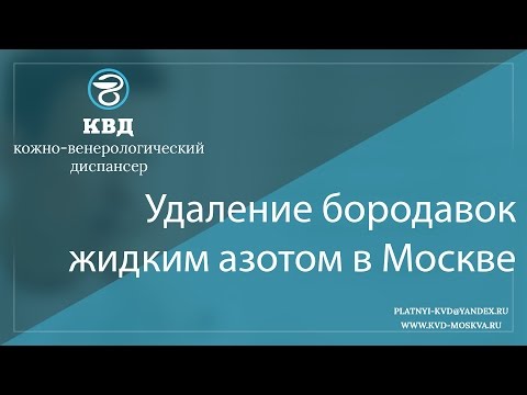 188  Удаление бородавок жидким азотом в Москве