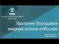 188  Удаление бородавок жидким азотом в Москве