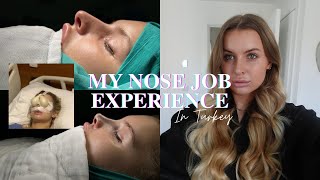 I GOT A NOSE JOB IN TURKEY | What to Expect & Rhinoplasty FAQ's!