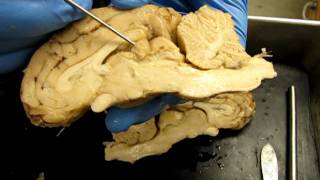 midsagittal.MOV