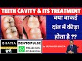 क्या वाकई दांत में कीड़ा होता है ??-Teeth cavity &amp; its treatment