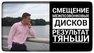 Смещение межпозвоночных дисков. Результат Тяньши. Отзыв Тиенс Tiens Смещение межпозвоночных дисков. Результат Тяньши. Отзыв Тиенс Tiens