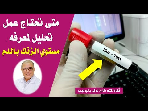 متى تحتاج عمل تحليل لمعرفه مستوى الزنك بالدم اهمية تحليل الزنك فى الجسم
