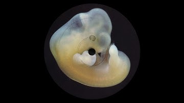 Bergqvist - Apollo 11 [ANIARA035]