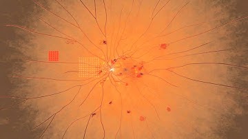 Topcon PASCAL Patterns