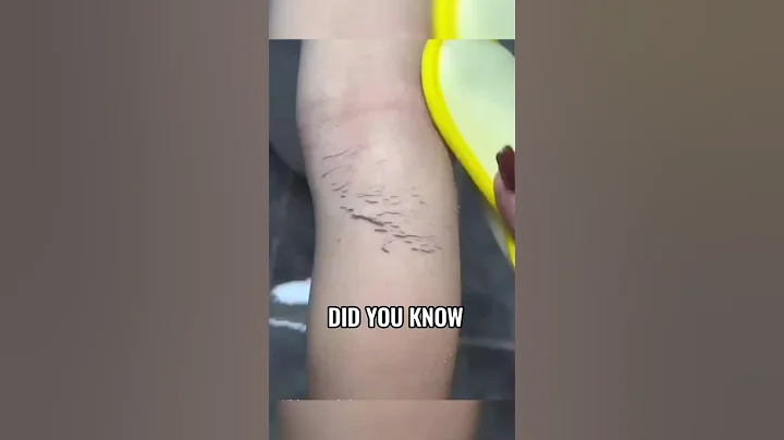 Dermasuri Exfoliating Glove: Ultimate Body Scrubber for Smooth Skin | Remove Dead Skin & Spray Tan