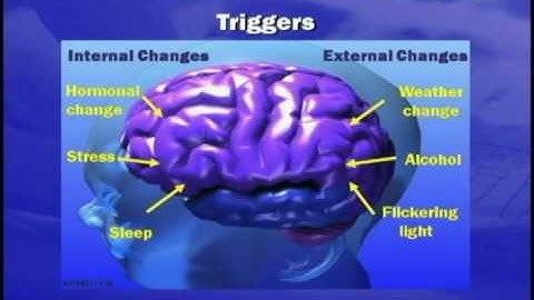 Andrew Blumenfeld on Migraine Pathophysiology - part 2