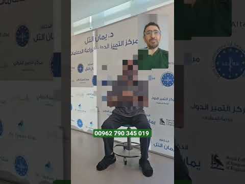 الدعامة الهيدروليكية تجعلك سعيد خرة اخرى